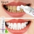 Mousse de Clareamento Dental para Limpeza de Dentes Remove Manchas Essência de Higiene Bucal