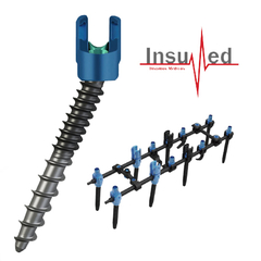 Sistema Transpendicular