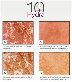 HYDRA 10 - Corporal - Bella Locura