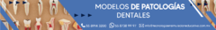 Banner de la categoría MODELOS DE PATOLOGÍAS DENTALES