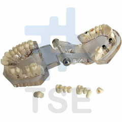 modelos de estudio para implantes dentales