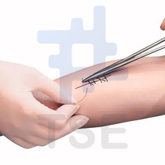 sutura brazo