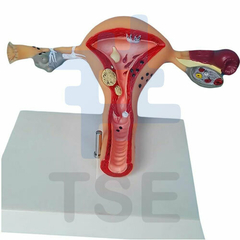  modelo de utero con patologias
