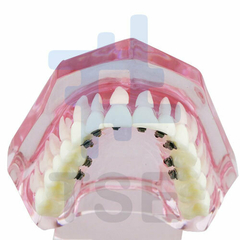modelo de dientes para dentistas