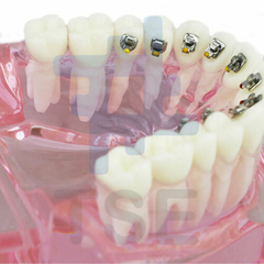 Modelos dentales para estudiantes de ortodoncia 
