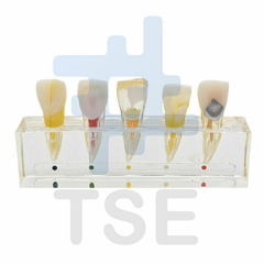 dientes nissin para endodoncia