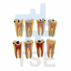 dientes simuladores para endodoncia