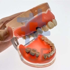 tipodontos dentales