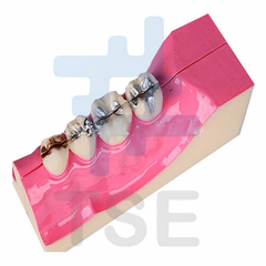 tipodonto periodoncia