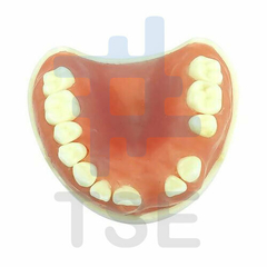 modelo de enfermedad periodontal