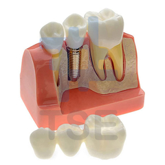 unidades dentales, unidades fashident, venta de equipo dental, unidades dentales economicas