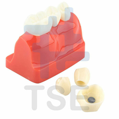 Modelo anatomico dental de puente