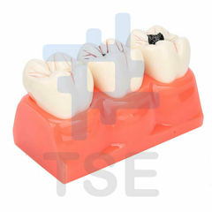 frasaco dental 