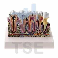 tipodonto dental patologías