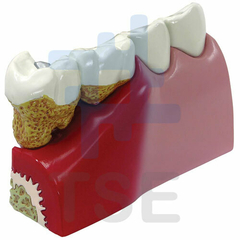 tipodonto dental patologías