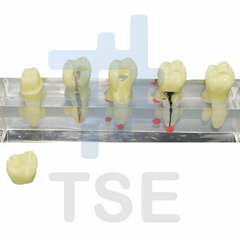 modelos de estudio ortodoncia precio