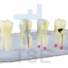 modelos de estudio ortodoncia precio