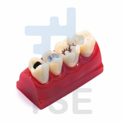 modelo practica dientes maxilares