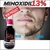 Kit 3 Minoxidil al 13% Follix - Minoxidil Follix