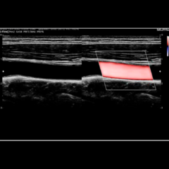 Equipamento de Ultrassom Samsung HS50