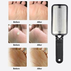 Foot Rasp File Callus Remover Pedicure Tool Dead Hard Skin Scraper Scrubber Tool - AZESHOP