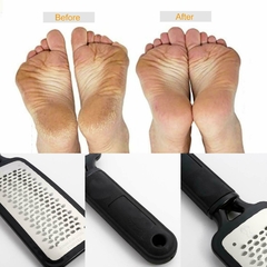 Foot Rasp File Callus Remover Pedicure Tool Dead Hard Skin Scraper Scrubber Tool - AZESHOP