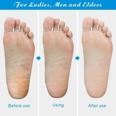 Foot Rasp File Callus Remover Pedicure Tool Dead Hard Skin Scraper Scrubber Tool na internet