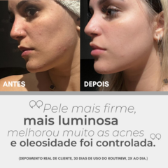 Kit 3 Meses - Serum Renovador Routinew Retinol + Resveratrol + Ácido Hialurônico na internet