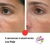 Fototerapia / Corrección Facial / Mascara LED - comprar online