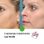 Fototerapia / Corrección Facial / Mascara LED en internet