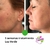 Fototerapia / Corrección Facial / Mascara LED - Evaluna