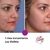 Fototerapia / Corrección Facial / Mascara LED - tienda online