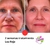 Imagen de Fototerapia / Corrección Facial / Mascara LED