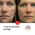 Fototerapia / Corrección Facial / Mascara LED