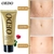 Creme OEDO Rose remove estrias da obesidade pós-parto, creme anti-rugas, anti-envelhecimento, - comprar online