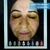 Imagen de SCANER ANALIZADOR FACIAL