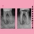 Endodoncia Molar - comprar en línea