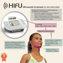 EQUIPO HIFU - comprar online