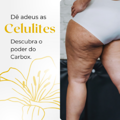 Carboxiterapia - Pacote com 5 sessões