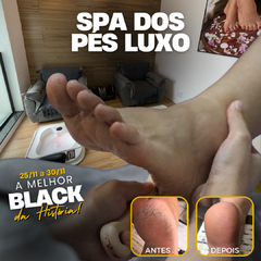 Spa dos Pés Luxo