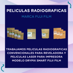 Pelicula Radiografica Laser Fuji Film Di-hl - tienda online