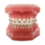 Brackets Biomim Roth/MBT - RB Orthodontics