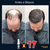 Hair-Growth anti-perda de cabelo para homens e mulheres, Crescimento Capilar Rápido! - loja online