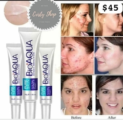 Crema bioaqua para acne