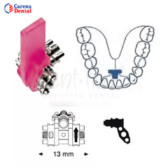 TORNILLO EXPANSIÓN TRIPLE LEONE ORTODONCIA ODONTOLOGÍA - comprar online