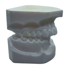 Modelo de estudio para ortodoncia Dentaurum - OutLetDental.mx