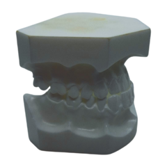 Modelo de estudios para Ortodoncia Dentaurum - OutLetDental.mx