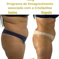 Emagrecimento com Soroterapia - comprar online