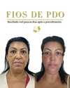 Fios de PDO