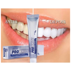 Kit Dental Pro White Blanqueadora - tienda online